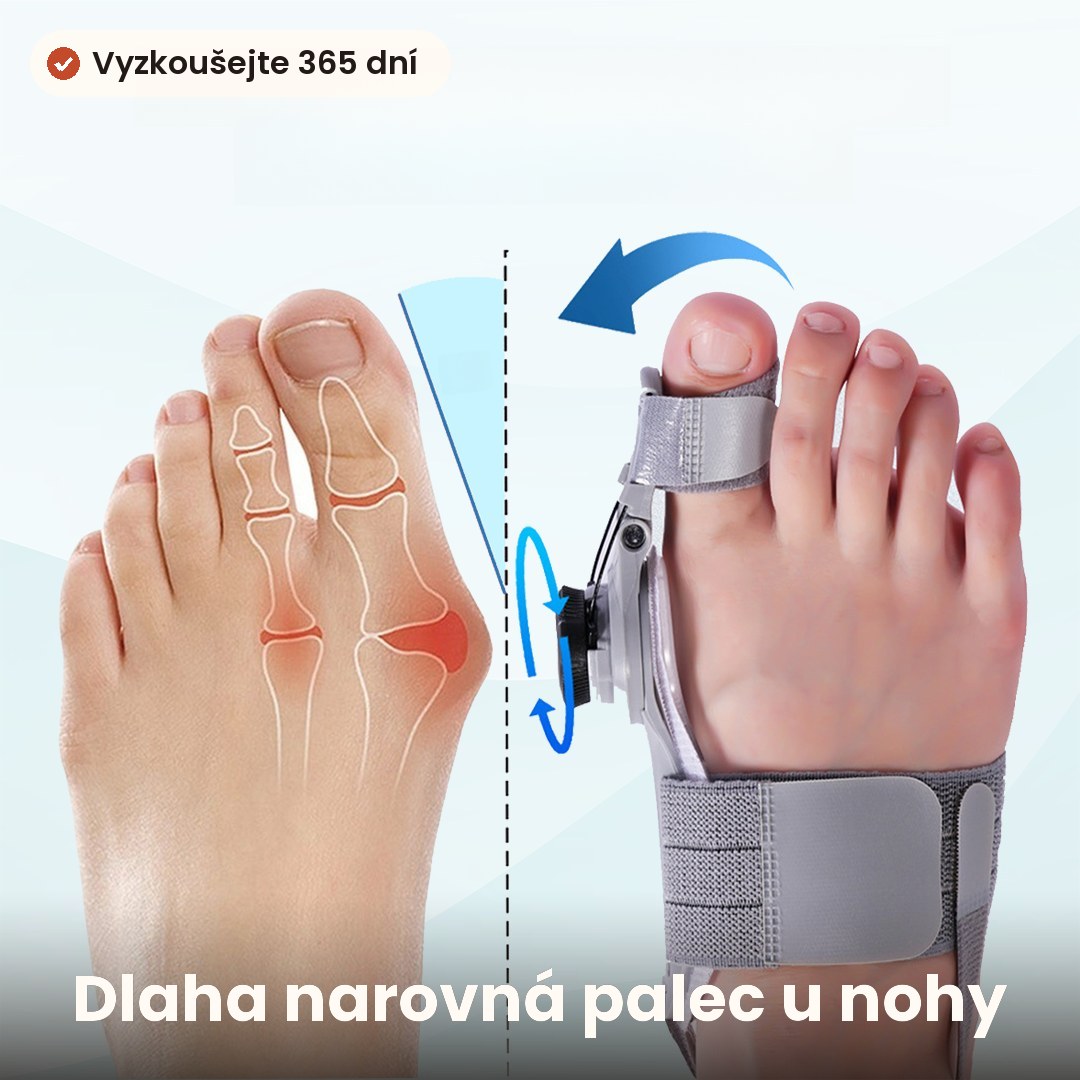 Dlaha na vybočený palec u nohy