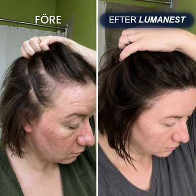 Före och efter Lumanest