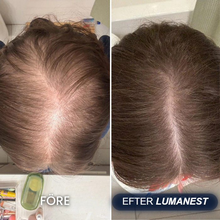 Före och efter Lumanest