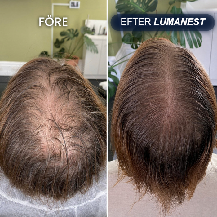 Före och efter Lumanest