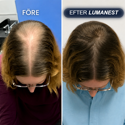 Före och efter Lumanest