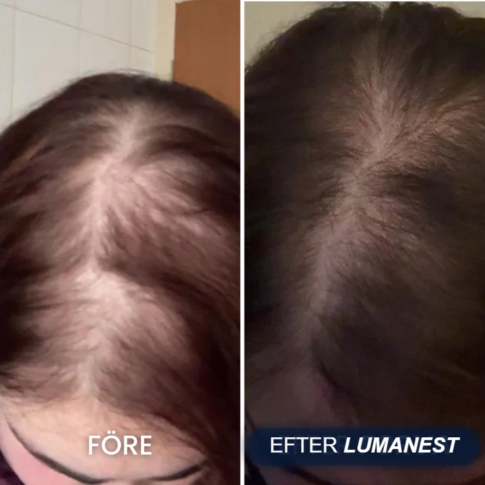 Före och efter Lumanest